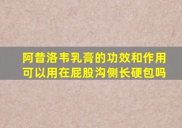 阿昔洛韦乳膏的功效和作用可以用在屁股沟侧长硬包吗